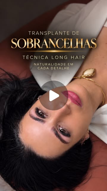 Reel: transplante de sobrancelhas, técnica Long Hair